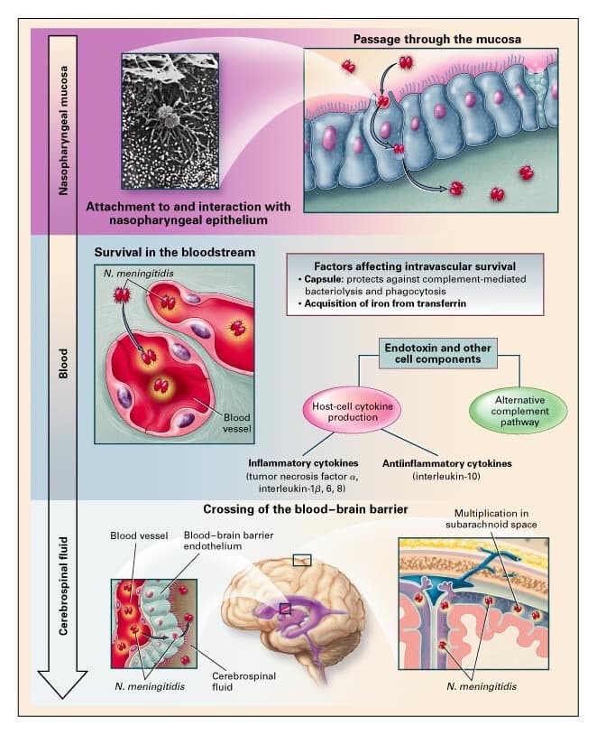 Meningitis (HCP)