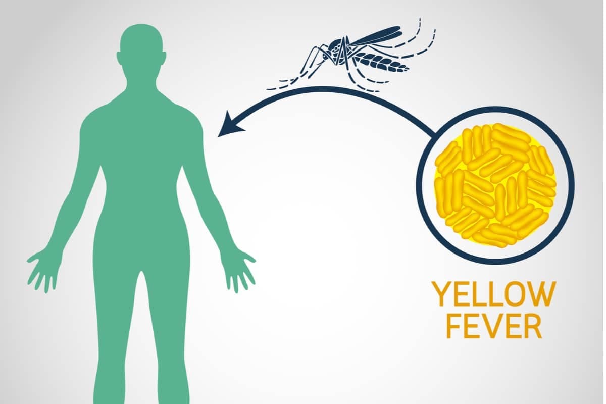 Yellow fever