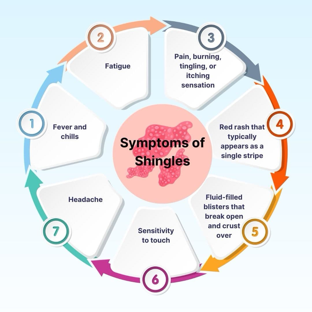 Shingles (HCP)